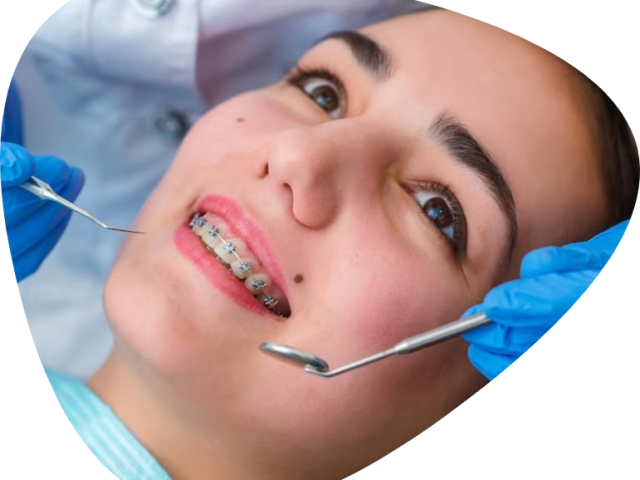 c-braces-treatment-tooth-extraction-for-better-smile