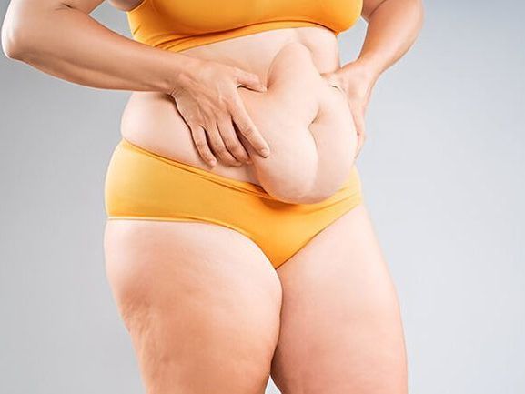 how-to-choose-the-best-surgeon-for-tummy-tuck-surgery-in-india
