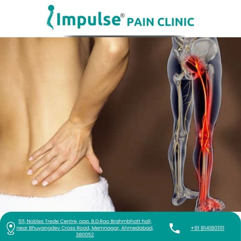 fast-recovery-support-with-sciatica-pain-treatment-in-ahmedabad-big-0