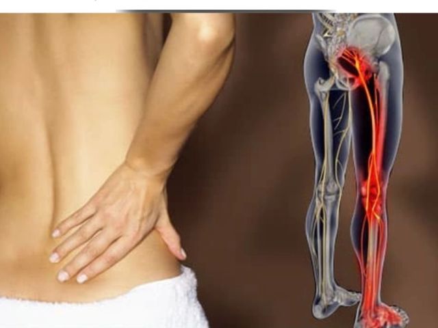 fast-recovery-support-with-sciatica-pain-treatment-in-ahmedabad