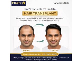 best-facial-aesthetic-clinics-in-electronic-city-small-0
