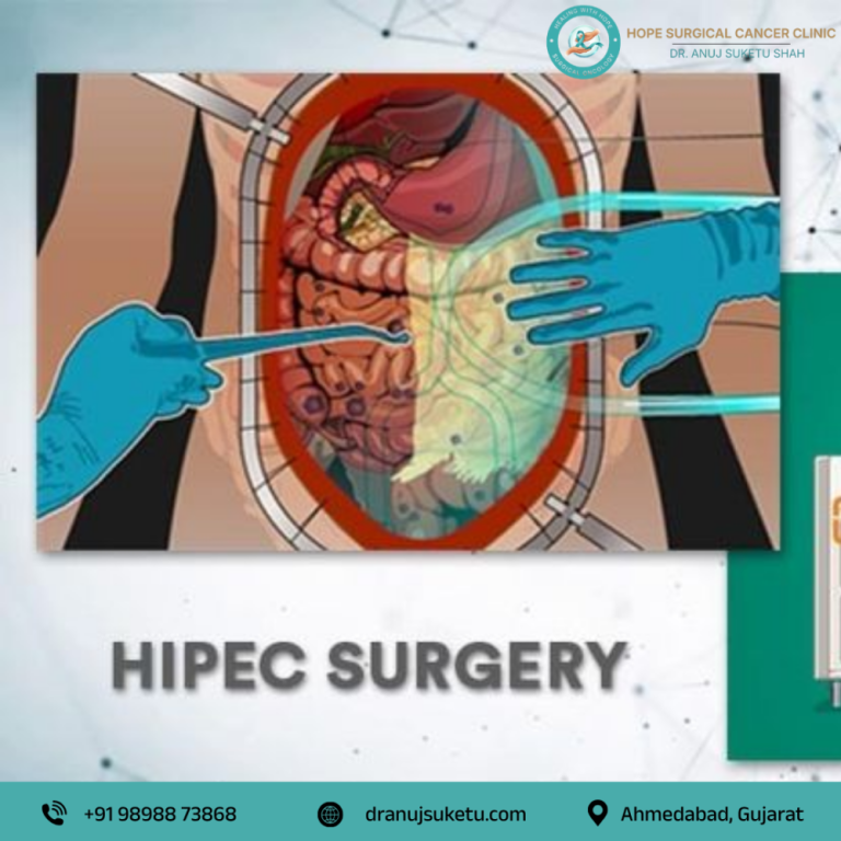 best-hipec-treatment-in-ahmedabad-by-expert-surgical-oncologist-big-0