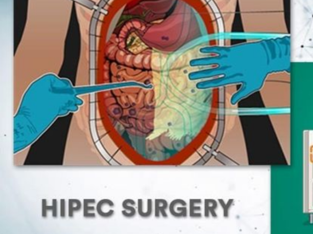 best-hipec-treatment-in-ahmedabad-by-expert-surgical-oncologist
