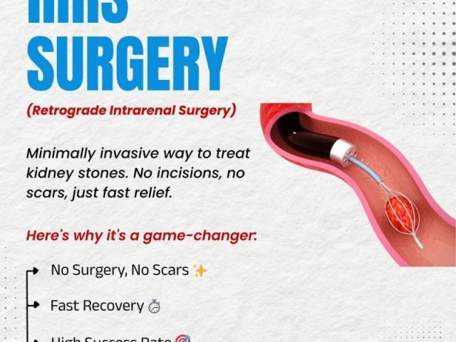 minimally-invasive-rirs-in-ahmedabad-for-kidney-stones