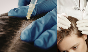 advanced-hair-treatments-for-effective-hair-fall-control-big-0