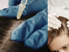 advanced-hair-care-treatments-for-naturally-thick-hair