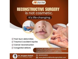 face-reconstruction-surgery-kolkata-expert-care-small-0