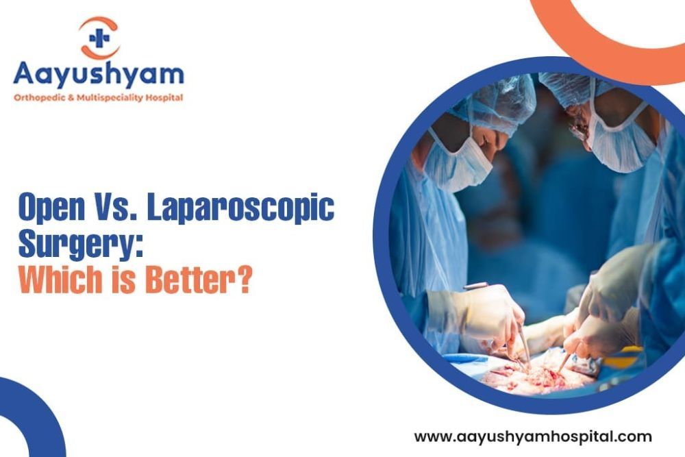 open-vs-laparoscopic-surgery-which-is-better-big-0
