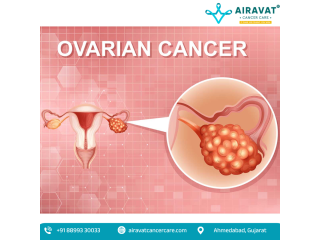ovarian-cancer-treatment-in-ahmedabad-with-surgical-expertise-small-0