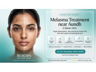 melasma-treatment-near-aundh-small-0