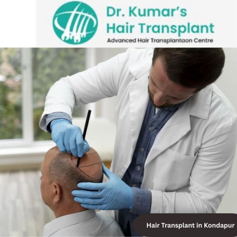 effective-hair-transplant-in-kondapur-for-natural-looking-results-big-0