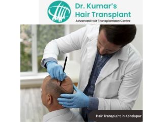 effective-hair-transplant-in-kondapur-for-natural-looking-results-small-0