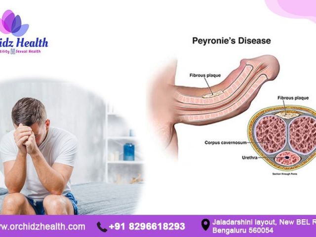 expert-penile-curvature-treatment-for-better-performance