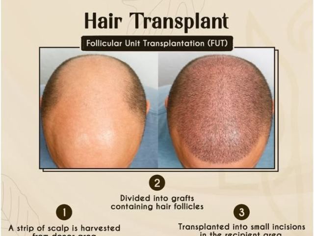 advanced-hair-gfc-treatment-ahmedabad-savannah-aesthetics
