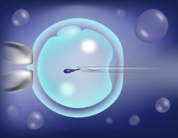 icsi-treatment-in-kolkata-advanced-fertility-care-big-0