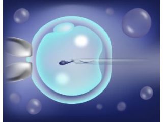 icsi-treatment-in-kolkata-advanced-fertility-care-small-0