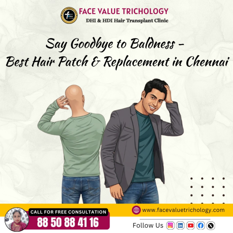 best-hair-patch-hair-replacement-treatment-in-chennai-big-0