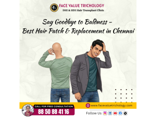 best-hair-patch-hair-replacement-treatment-in-chennai-small-0