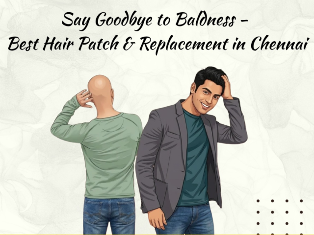 best-hair-patch-hair-replacement-treatment-in-chennai
