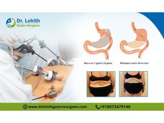 find-the-best-laparoscopic-bariatric-surgeon-in-bangalore-small-0