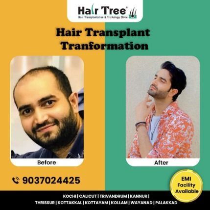 hair-tree-clinic-expert-hair-transplant-prp-in-kerala-big-0