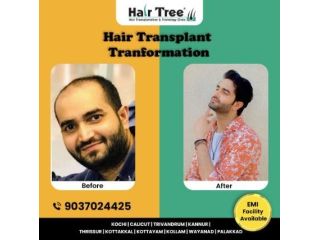 hair-tree-clinic-expert-hair-transplant-prp-in-kerala-small-0