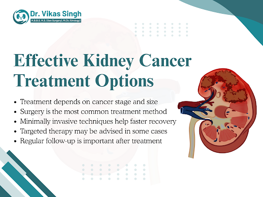 best-kidney-cancer-doctor-in-indore-for-expert-care