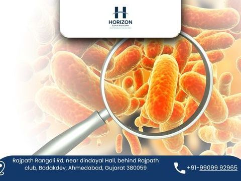 expert-support-for-cancer-surgery-and-treatment
