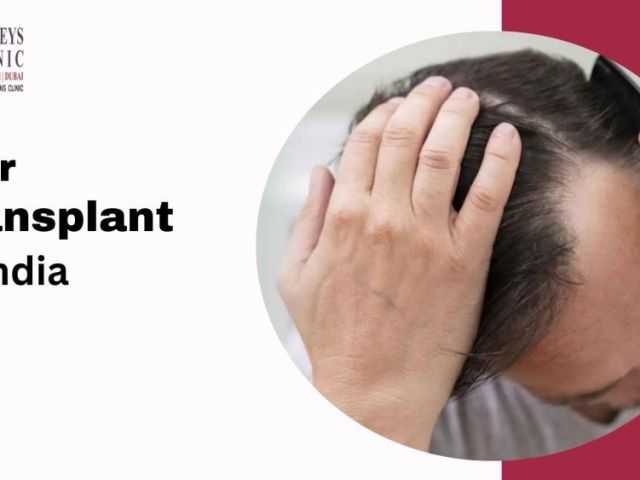 hair-transplant-in-india-trusted-surgeons-latest-techniques