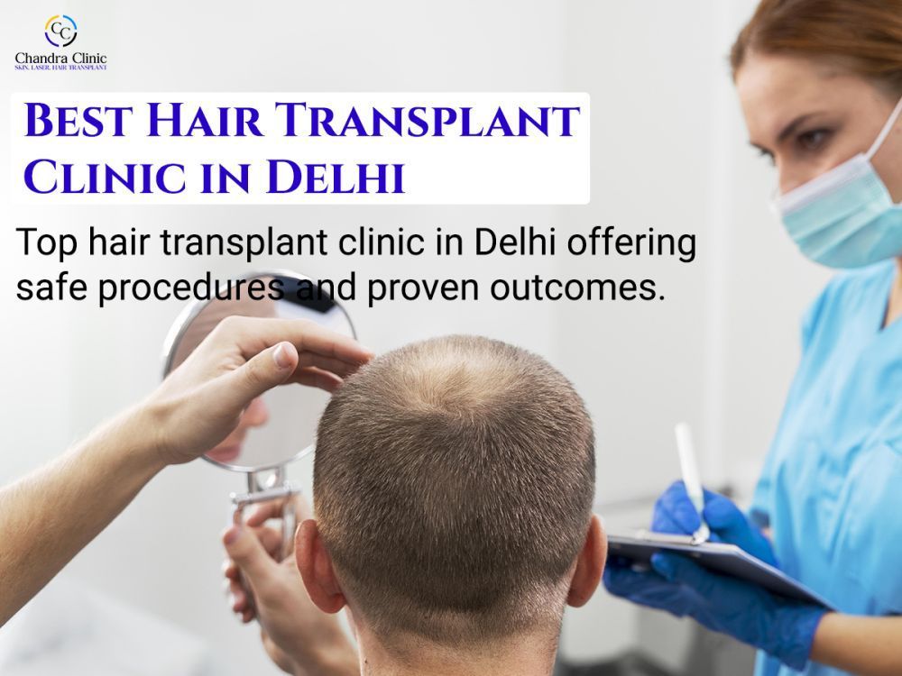 looking-for-the-best-hair-transplant-clinic-in-delhi-big-0