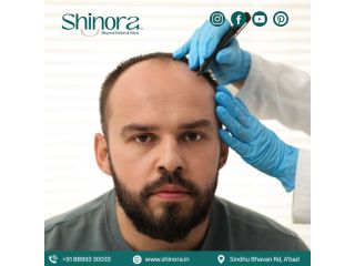 natural-results-with-hair-transplant-in-ahmedabad-small-0