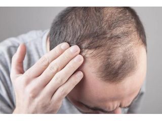dermatology-clinic-in-ahmedabad-small-0