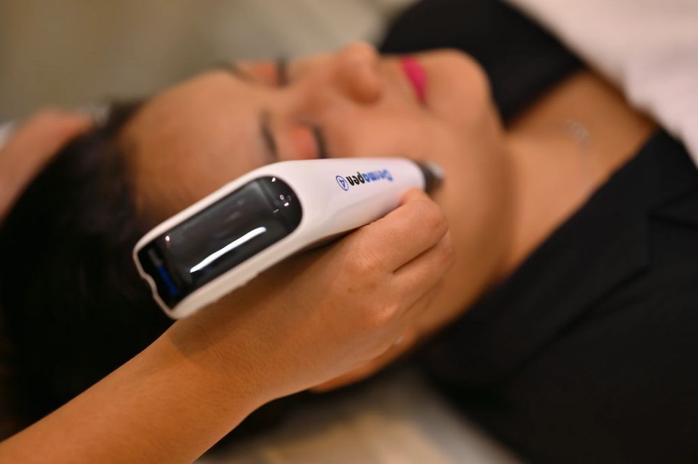 microneedling-treatment-bangalore-auguste-skin-big-0