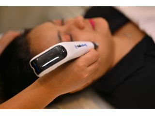 microneedling-treatment-bangalore-auguste-skin-small-0