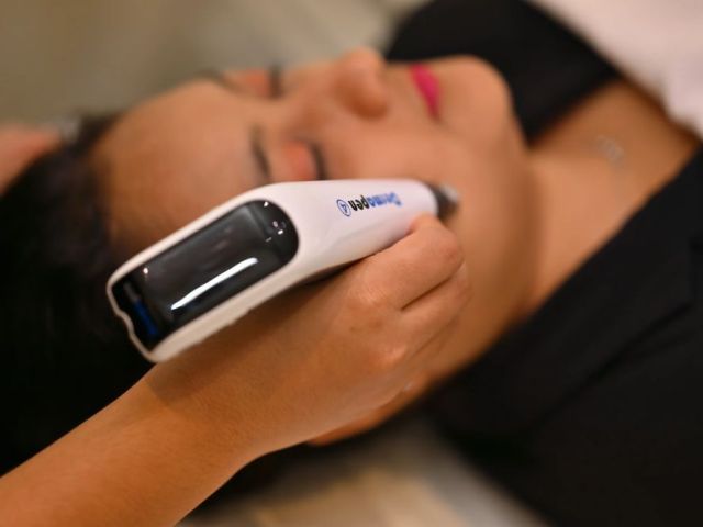 microneedling-treatment-bangalore-auguste-skin