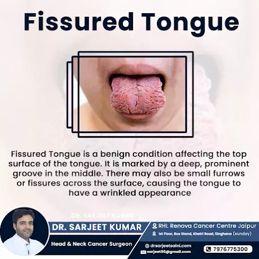 dr-sarjeet-kumar-saini-head-neck-cancer-surgeon-jaipur-big-0