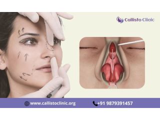 precision-rhinoplasty-treatment-available-in-surat-small-0
