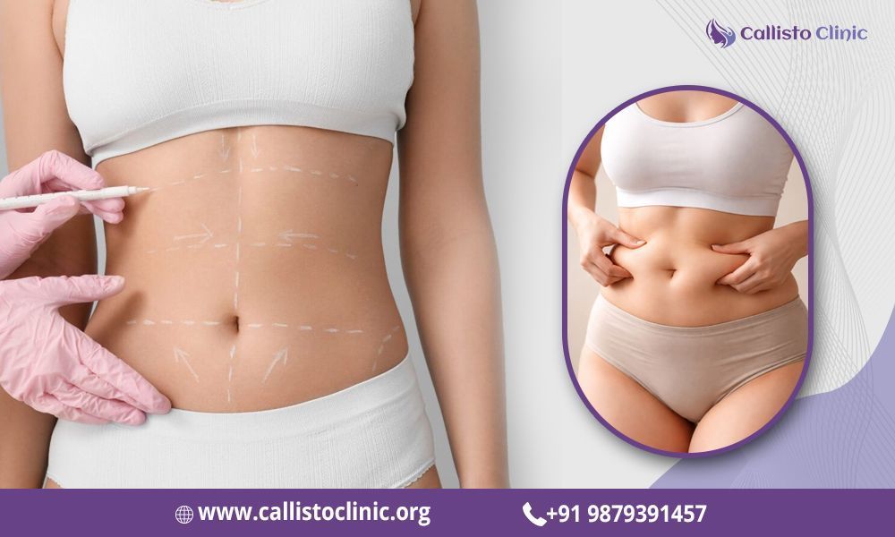 liposuction-services-by-dr-rushin-thakor-callisto-clinic-big-0