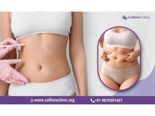 liposuction-services-by-dr-rushin-thakor-callisto-clinic-small-0