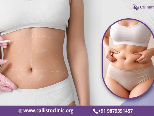liposuction-services-by-dr-rushin-thakor-callisto-clinic