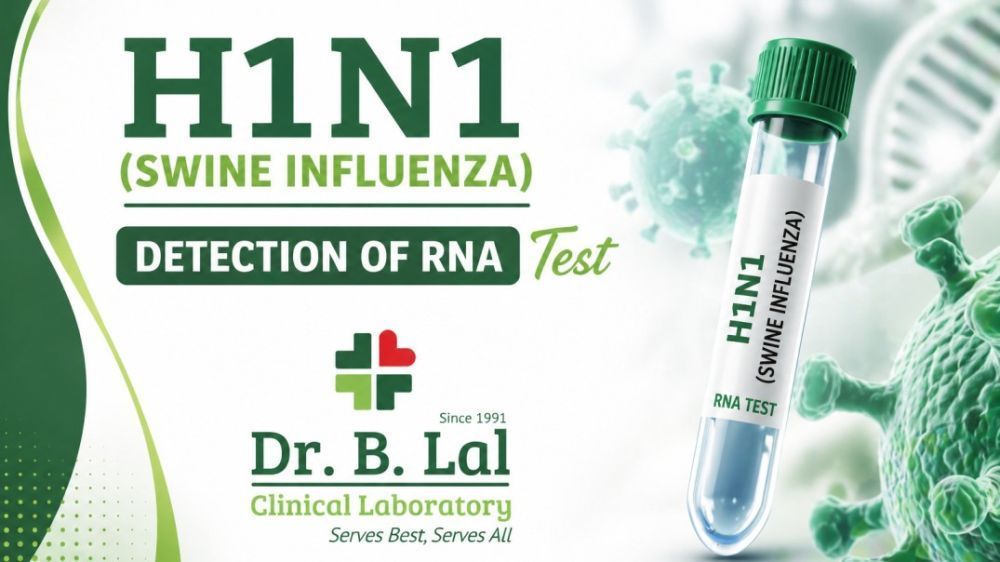 swine-flu-h1n1-rt-pcr-test-in-jaipur-home-collection-big-0