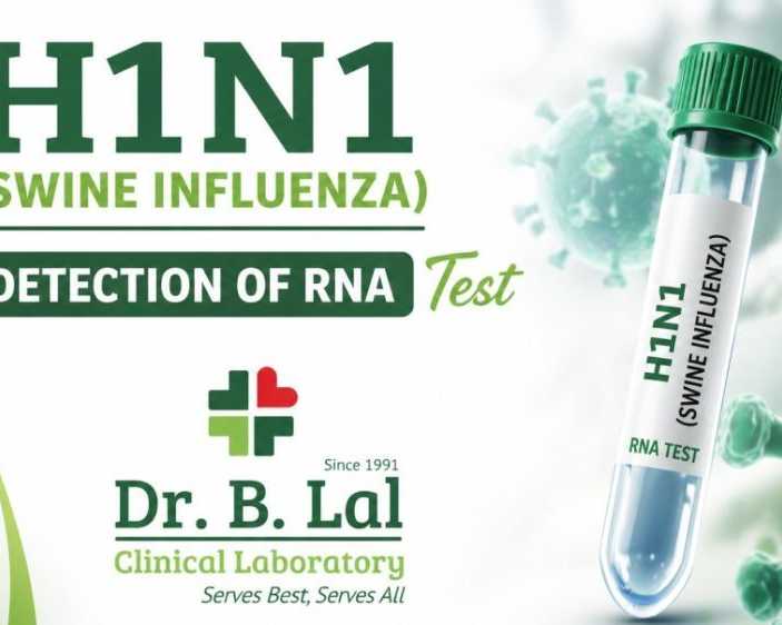 swine-flu-h1n1-rt-pcr-test-in-jaipur-home-collection