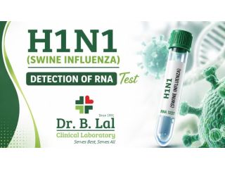 swine-flu-h1n1-rt-pcr-test-in-jaipur-home-collection-small-0