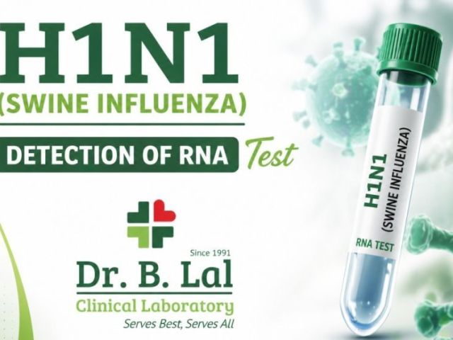 swine-flu-h1n1-rt-pcr-test-in-jaipur-home-collection