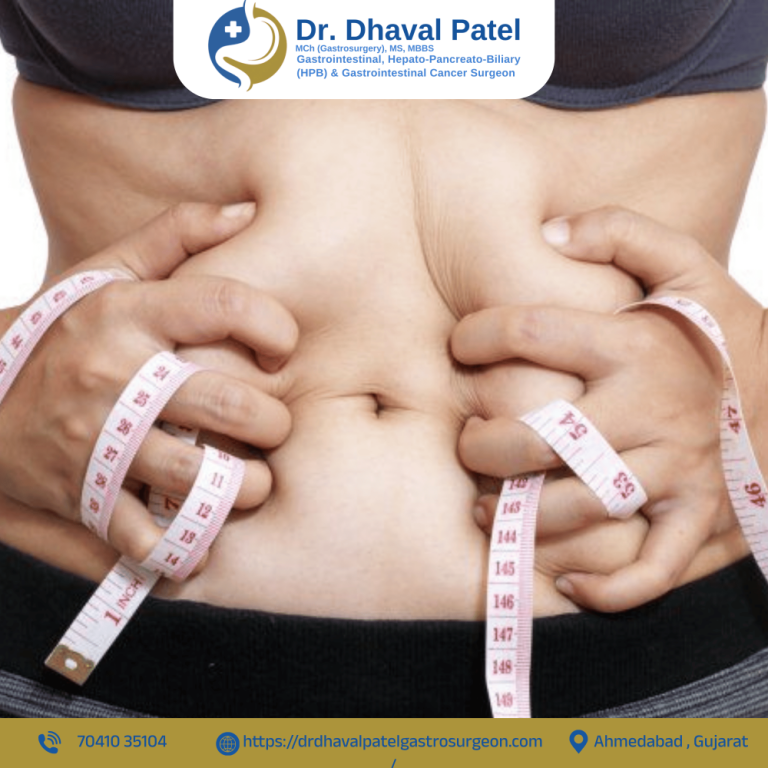 obesity-bariatric-metabolic-surgery-in-ahmedabad-big-0