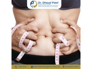 obesity-bariatric-metabolic-surgery-in-ahmedabad-small-0