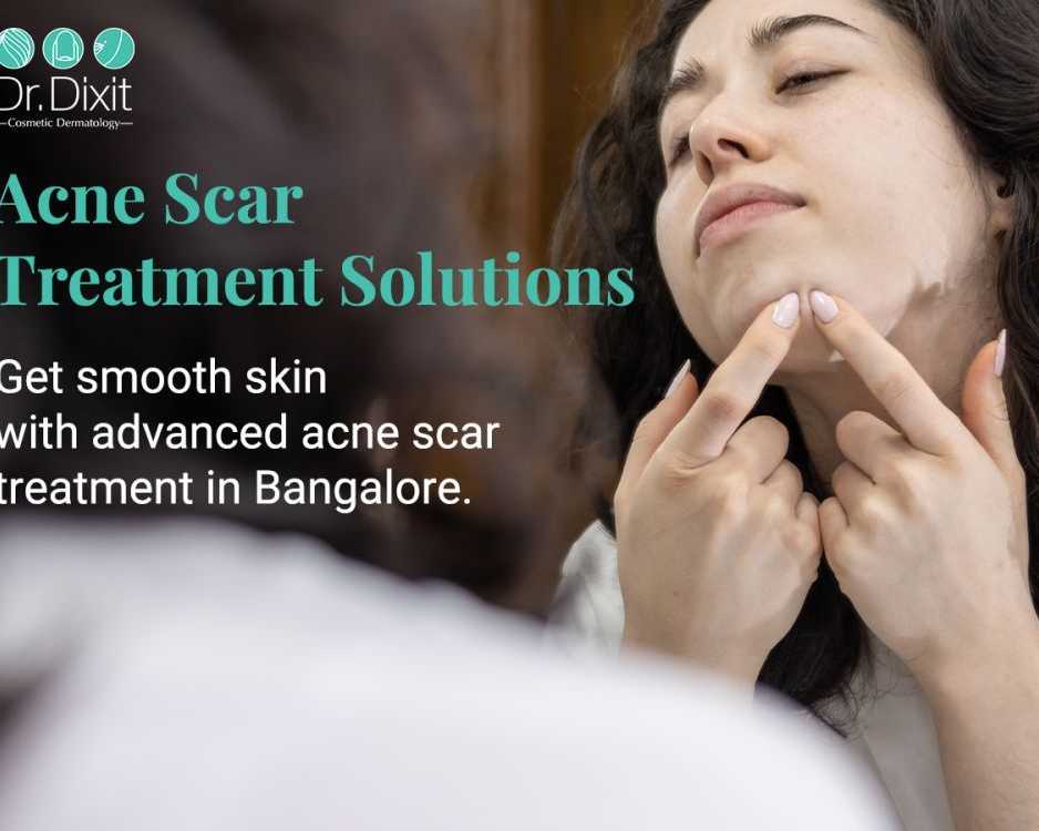 professional-acne-scar-removal-services-in-bangalore