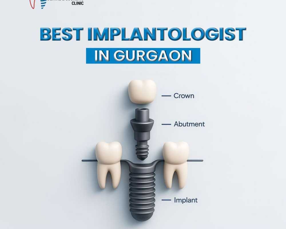 best-implantologist-in-gurgaon-for-advanced-dental-implants
