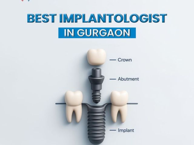 best-implantologist-in-gurgaon-for-advanced-dental-implants