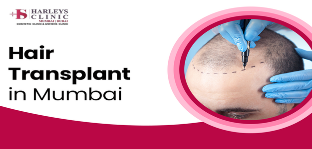 advanced-hair-transplant-in-mumbai-by-expert-surgeons-big-0
